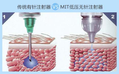 QQ图片20160113153528.png